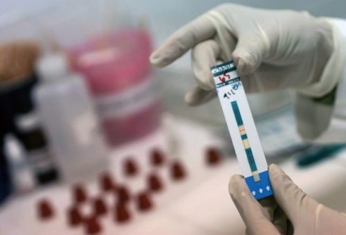 У селах Черкащини з’являться швидкі тести на ВІЛ