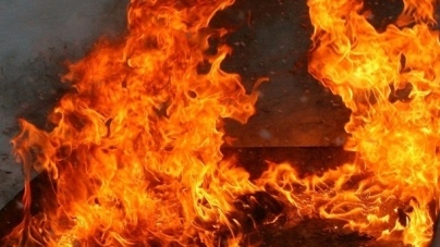 На Тальнівщині під час пожежі постраждав чоловік