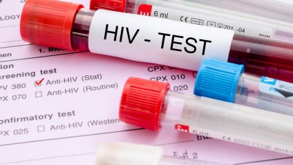 Черкащанам пропонують безкоштовно пройти тест на ВІЛ