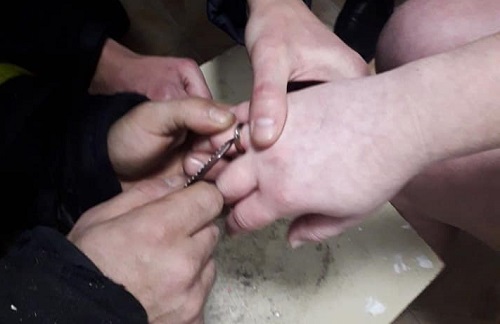 Рятувальники допомагали черкащанці зняти обручку (фото, відео)