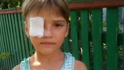 Маленька дівчинка може втратити око: потрібні кошти на операцію