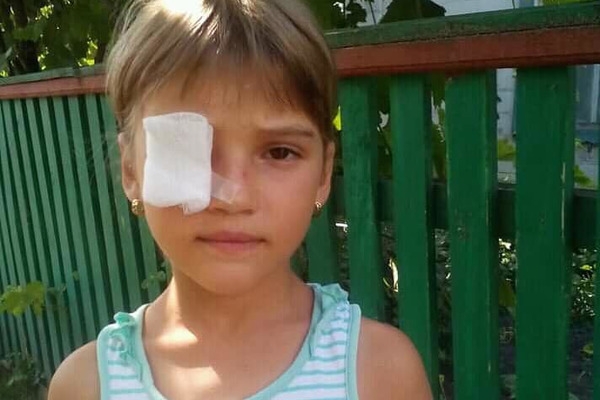 Маленька дівчинка може втратити око: потрібні кошти на операцію