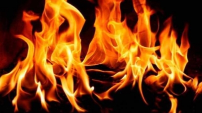 На Черкащині під час пожежі травмувалася жінка