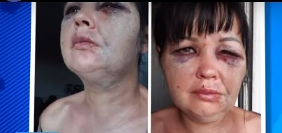 Черкащанин, якого звинувачують у побитті співмешканки, розповів свою версію подій (відео)