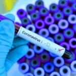 На Черкащині перший інфікований коронавірусом: стало відомо, де він проходить лікування