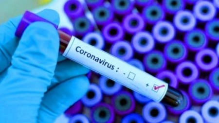 Станом на сьогодні у Черкасах немає жодного підтвердженого випадку захворювання на коронавірус