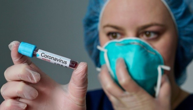 Друга хвора з коронавірусом на Черкащині – у стані середньої тяжкості