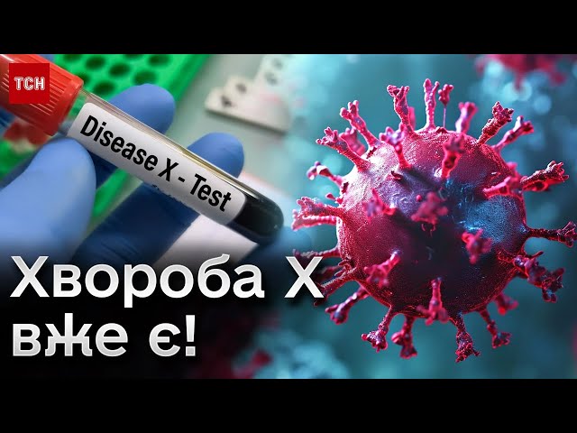 У МОЗ розповіли, як Україна готується до потенційної пандемії “хвороби Х”