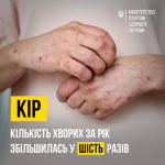 У 2023 році на кір в Україні захворіло ушестеро більше людей, ніж у 2022 році